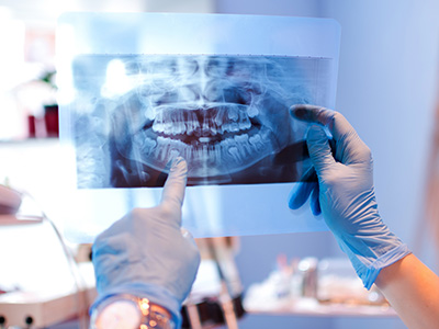An X-ray image of a person's teeth is being held up by a dental professional wearing gloves and a mask, standing in front of an office setting with medical equipment.