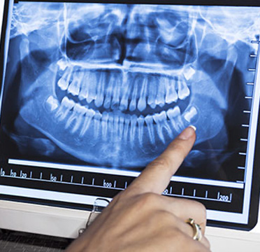 The image shows a person's hand pointing at an X-ray of a human skull with teeth and jaws visible, displayed on a digital screen.