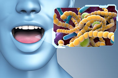 Image shows a human face with an open mouth, juxtaposed against a graphic of bacterial cells and biofilm.