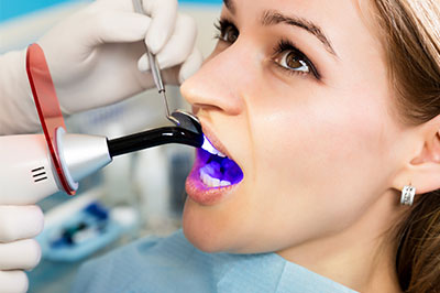 An image of a woman undergoing dental treatment, with her mouth open and a dental instrument in use.
