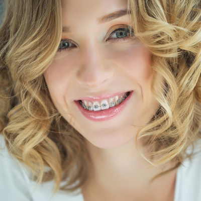 A smiling woman with straightened teeth, wearing braces.
