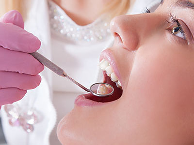 A dental professional performing a dental procedure on a patient, with the patient's mouth open and the professional using a dental tool.